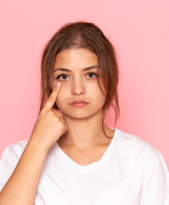 Top Causes of Dark Circles and How to Address Them