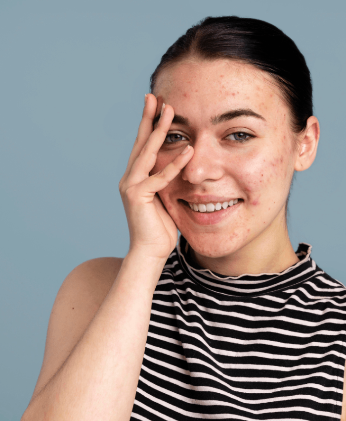 What Causes Dark Spots and How to Treat Them Effectively